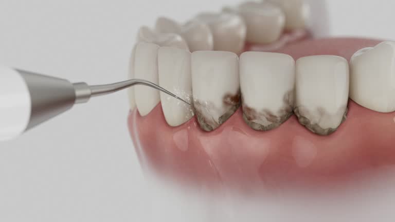 Reliable Dental contractor in Pineville, LA by Dentist Open Now